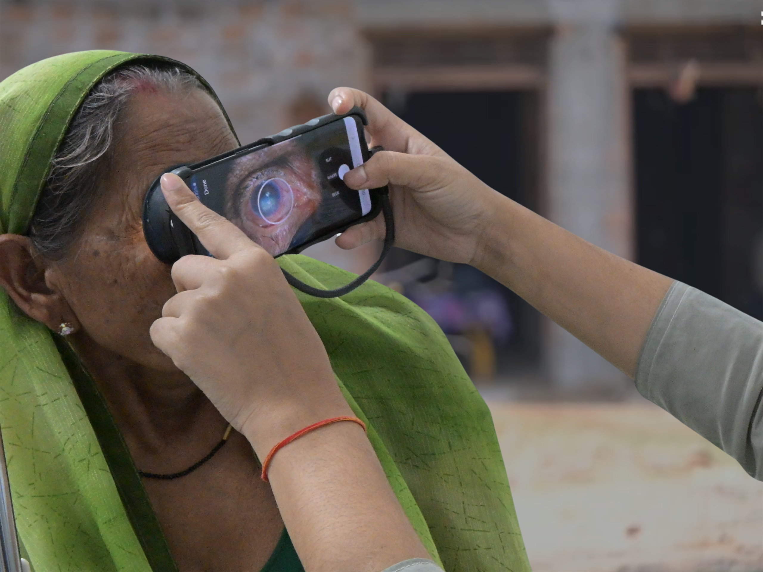 eye Imaging India annie cannons